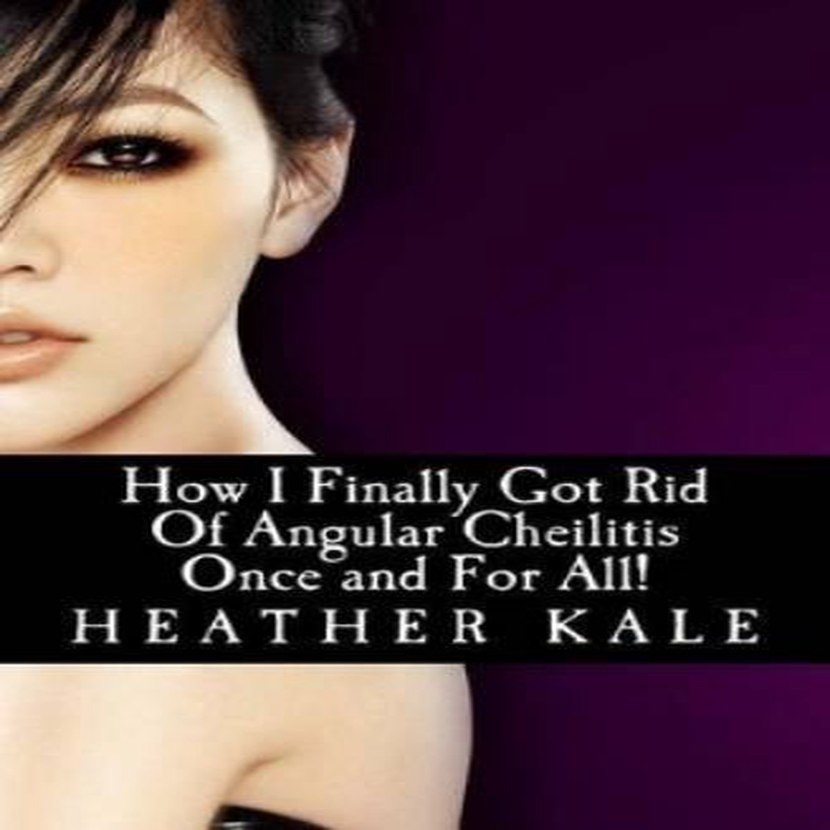How I Finally Got Rid Of Angular Cheilitis Once and For All!