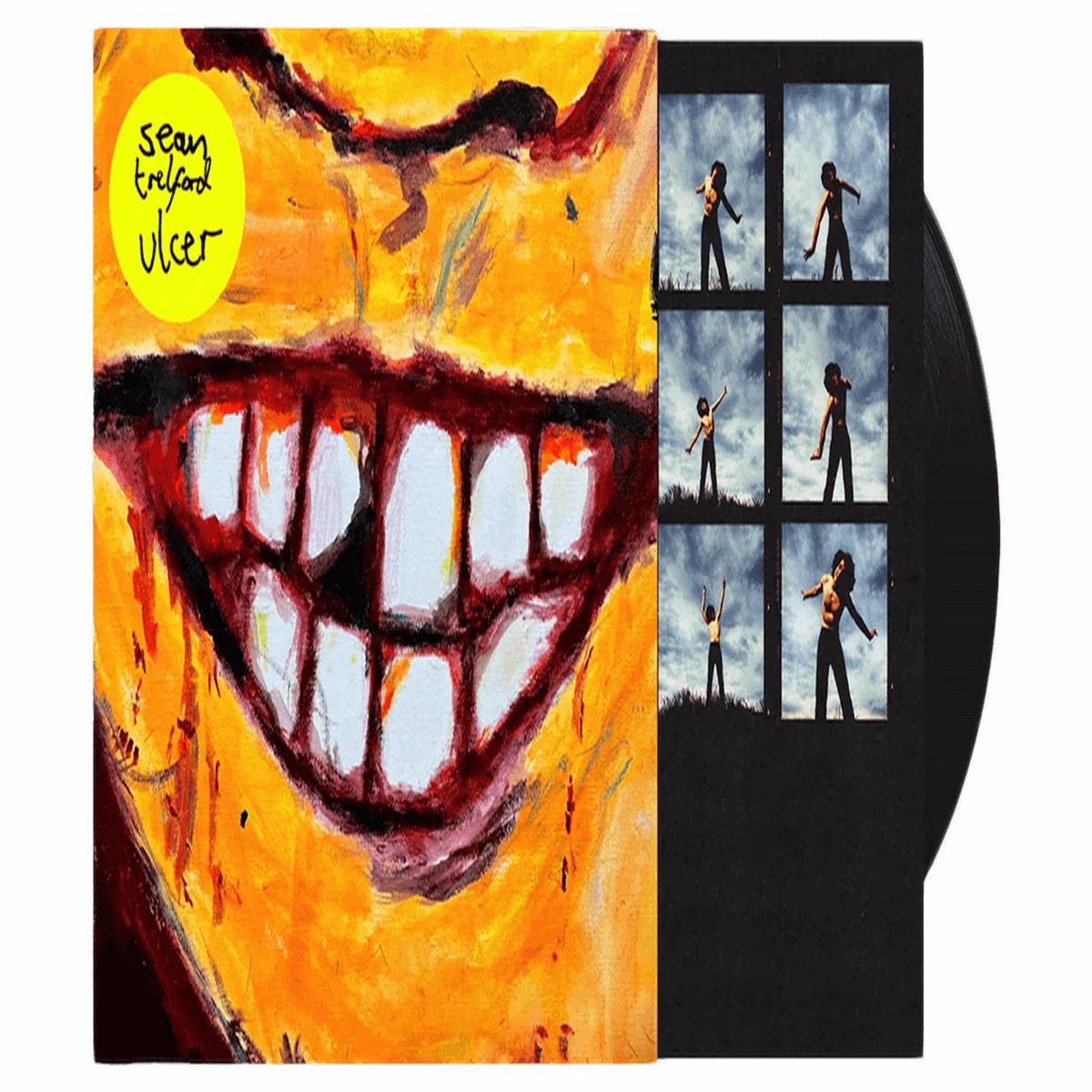 Sean Trelford : ulcer