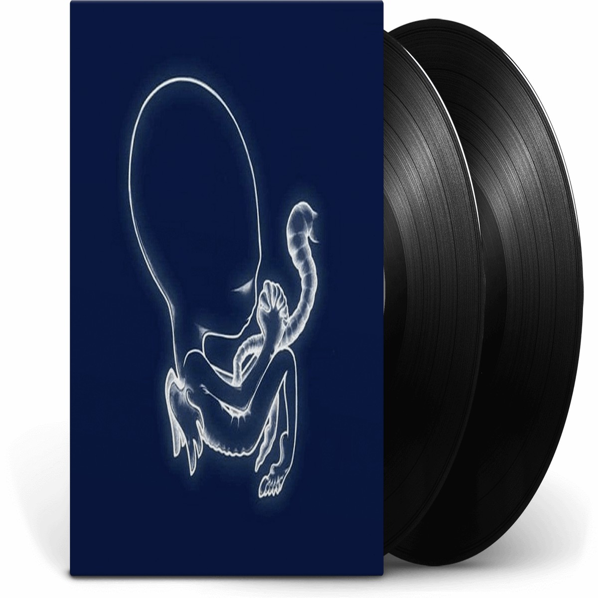 Sigur Rs : gtis byrjun